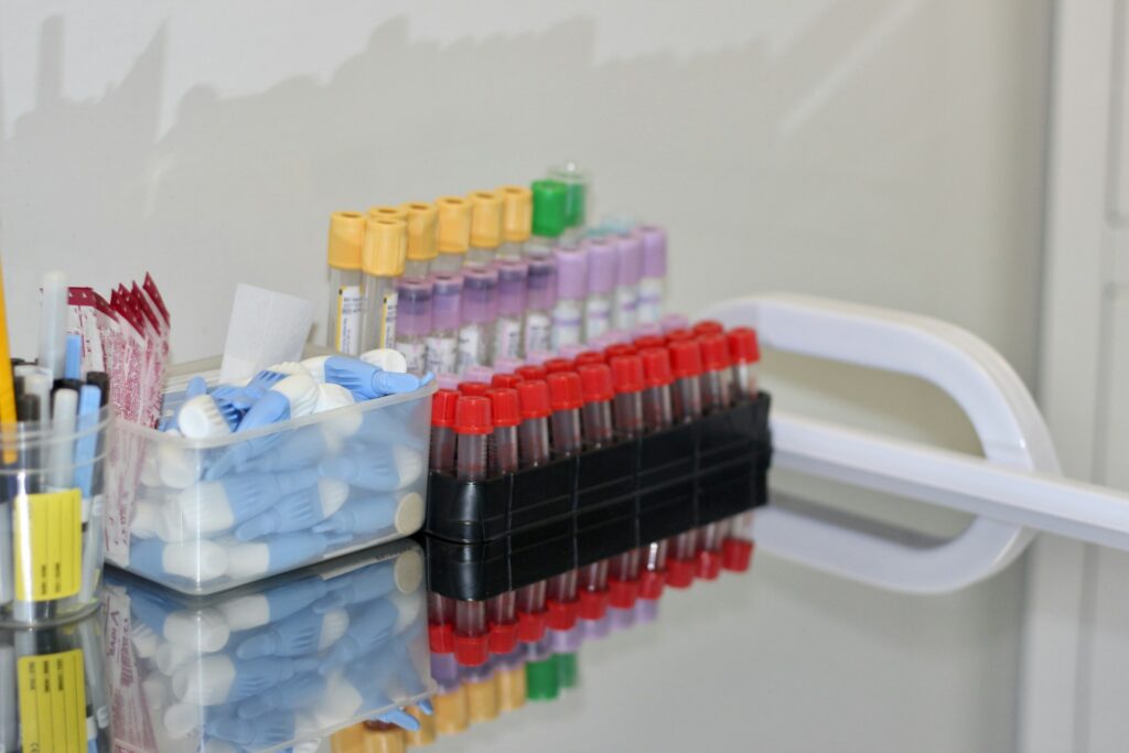 wyniki badań krwi z zaznaczonym poziomem witaminy B12 i homocysteiny