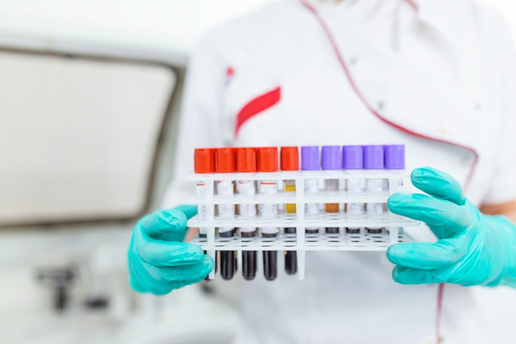 Badania glukozy HbA1c i OGTT w diagnostyce stanu przedcukrzycowego